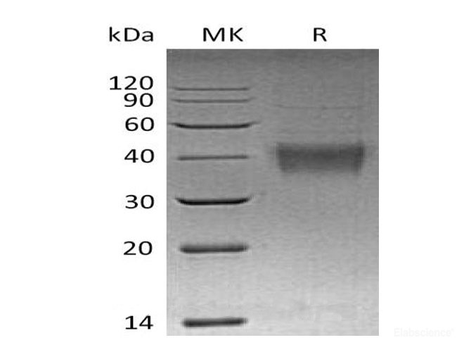 Recombinant Mouse TNF ligand superfamily member 9/TNFSF9Protein(N-10His) -Elabscience