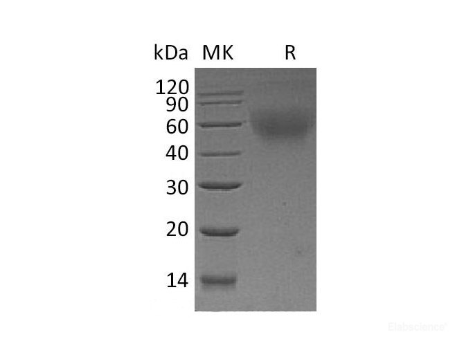 Recombinant Mouse TNFRSF8/CD30L Receptor/CD30 Protein(C-6His) -Elabscience