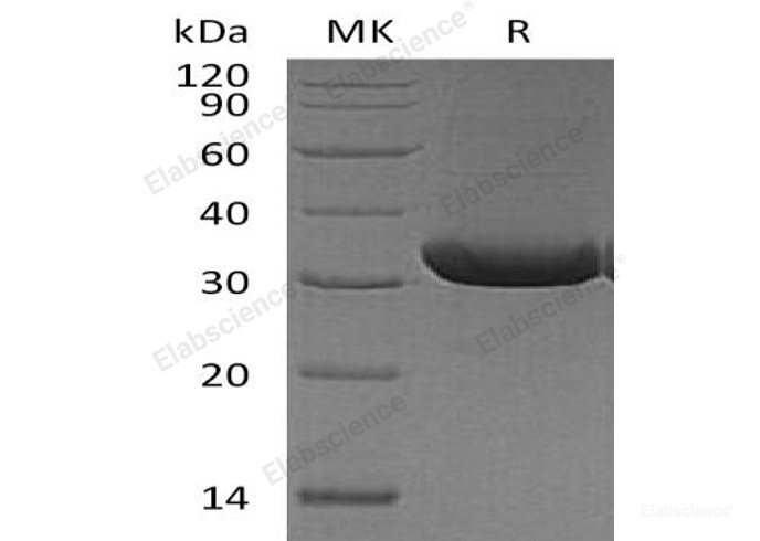 Recombinant Mouse TRANCE/RANK L/TNFSF11 Protein(C-6His)-Elabscience
