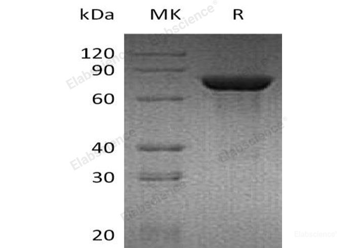 Recombinant Mouse Transglutaminase 2/TGM2 Protein(C-6His)-Elabscience