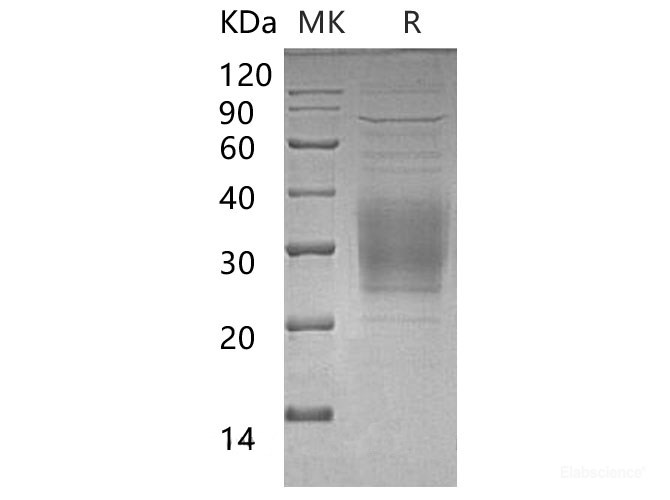 Recombinant Mouse Triggering Receptor Expressed on Myeloid Cells 2b/TREM-2b Protein(C-6His) -Elabscience