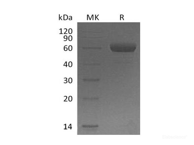 Recombinant Mouse Triggering Receptor Expressed on Myeloid Cells 2b/TREM-2b Protein(C-Fc) -Elabscience