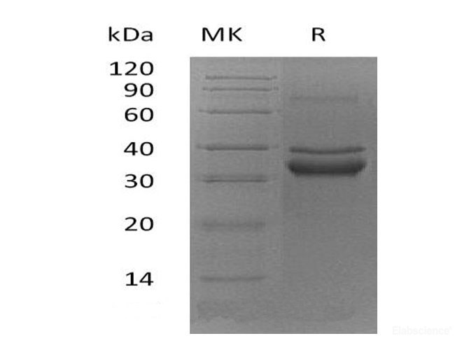 Recombinant Mouse TWEAK Receptor/TWEAK R/TNFRSF12A Protein(C-Fc)-Elabscience