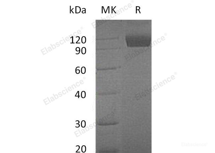 Recombinant Mouse Tyrosine-Protein Kinase Receptor TYRO3/DTK Protein(C-Fc) -Elabscience