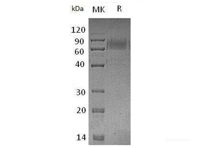 Recombinant Mouse Tyrosine-Protein Kinase Receptor TYRO3/Dtk Protein(C-mFc)-Elabscience