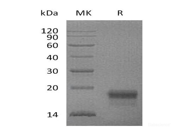 Recombinant Mouse VEGF-D/PIGF Protein(C-6His)-Elabscience