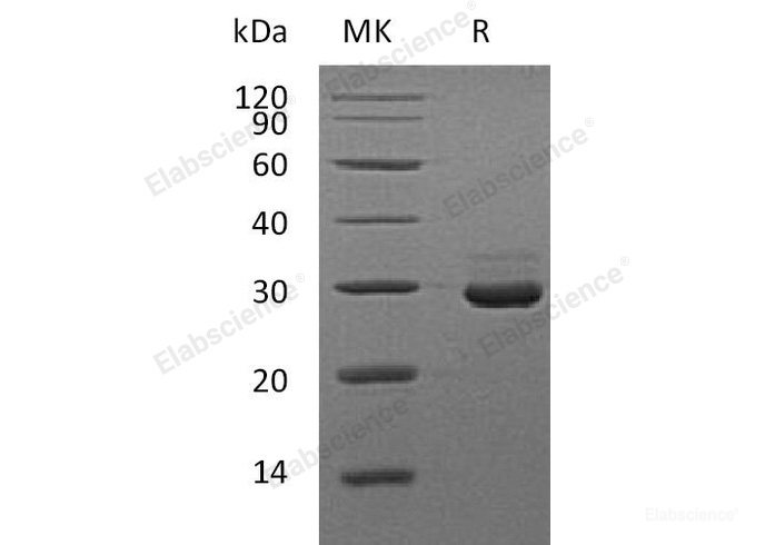 Recombinant Mouse V-Set and Ig Domain-Containing Protein 8/VSIG8 Protein(C-6His) -Elabscience