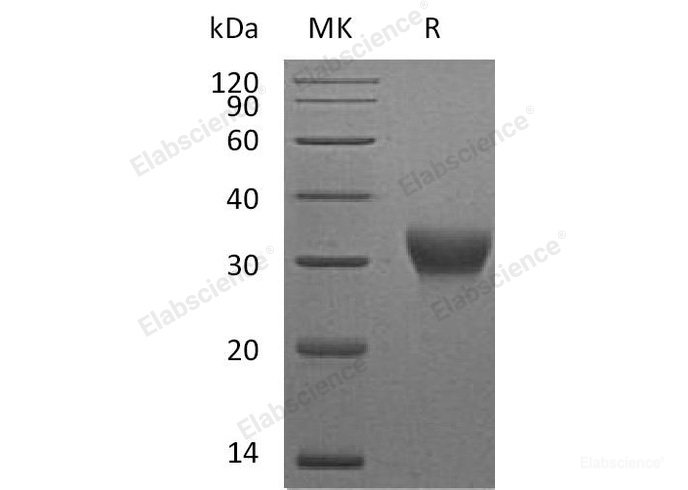 Recombinant Mouse VSIG4 Protein(C-6His) -Elabscience