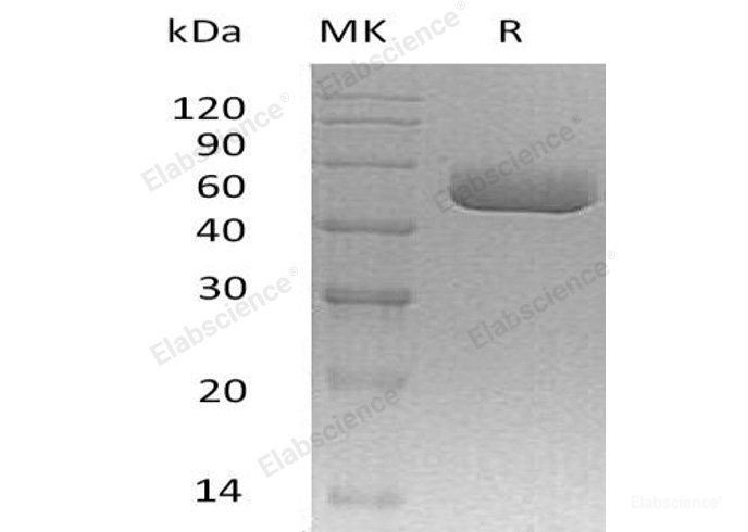 Recombinant Mouse α-1-Antitrypsin 1-3/SERPIN A1b Protein(C-6His)-Elabscience