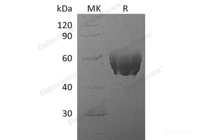 Recombinant Mouse α-2-HS-Glycoprotein//AHSG/Fetuin A Protein(C-10His) -Elabscience