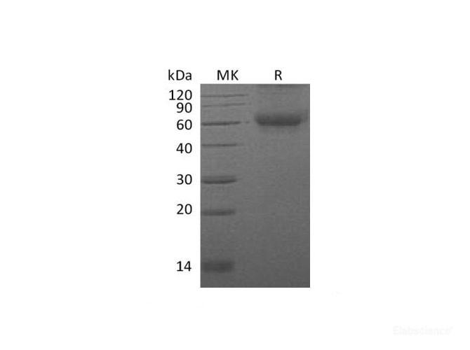 Recombinant Mouse Discoidin domain-containing receptor 2 Protein-Elabscience