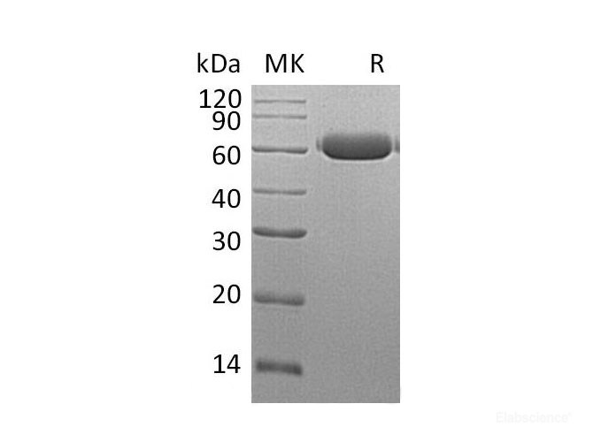 Recombinant Mouse Legumain/Asparaginyl Endopeptidase Protein-Elabscience