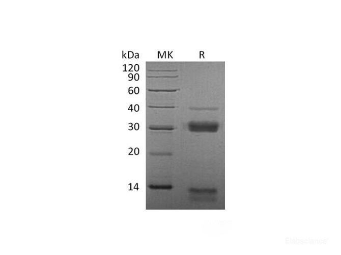 Recombinant Mouse Cathepsin S Protein-Elabscience