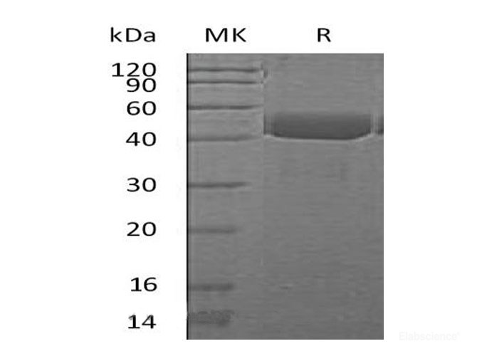 Recombinant Mouse Cathepsin E Protein-Elabscience