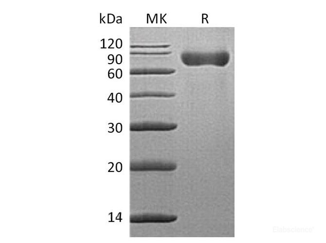 Recombinant Mouse T-lymphocyte surface antigen Ly-9 Protein-Elabscience
