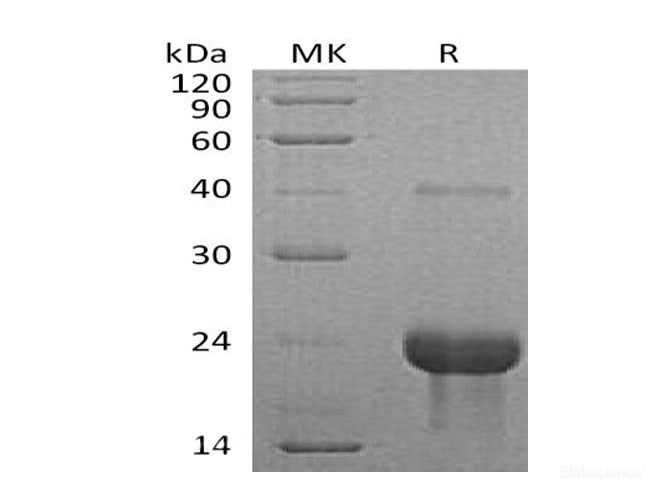 Recombinant Mouse Tumor Necrosis Factor Receptor I Protein-Elabscience