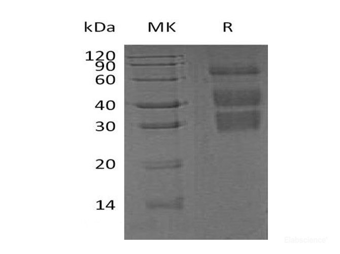 Recombinant Mouse Clusterin Protein-Elabscience