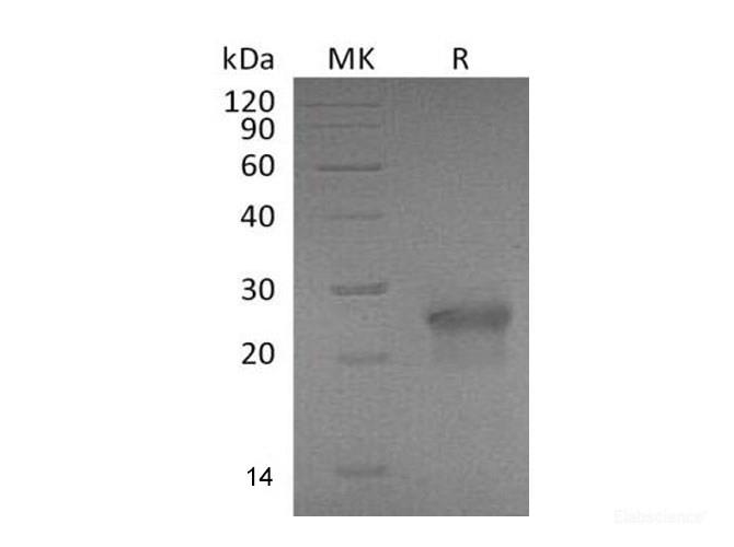 Recombinant Mouse Ectodysplasin A2 Receptor Protein-Elabscience