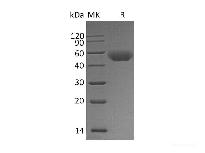 Recombinant Mouse T-Cell Surface Glycoprotein CD5 Protein-Elabscience