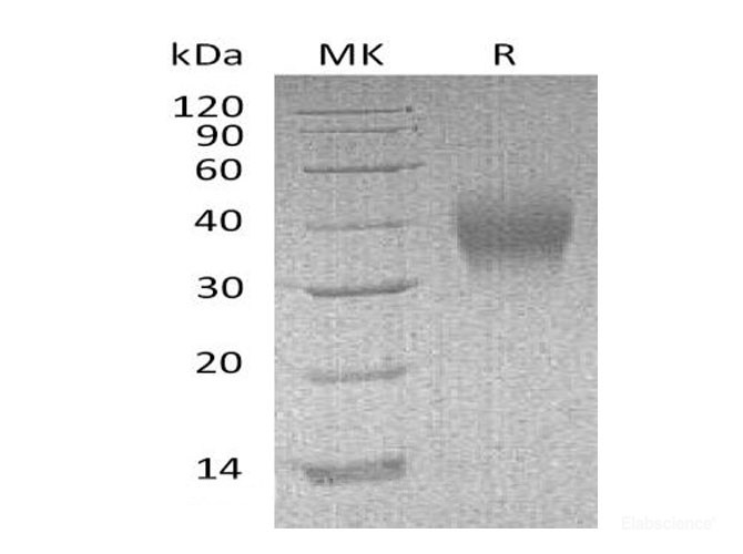 Recombinant Mouse Low affinity IgG Fc receptor III Protein-Elabscience