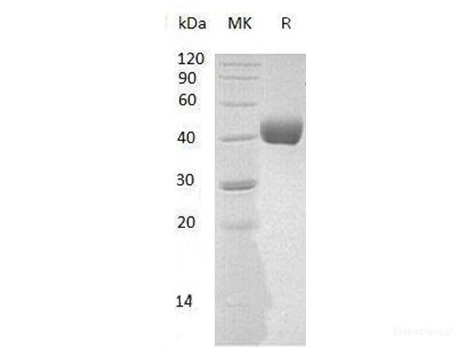Recombinant Mouse Poliovirus Receptor-Related Protein 2 Protein-Elabscience