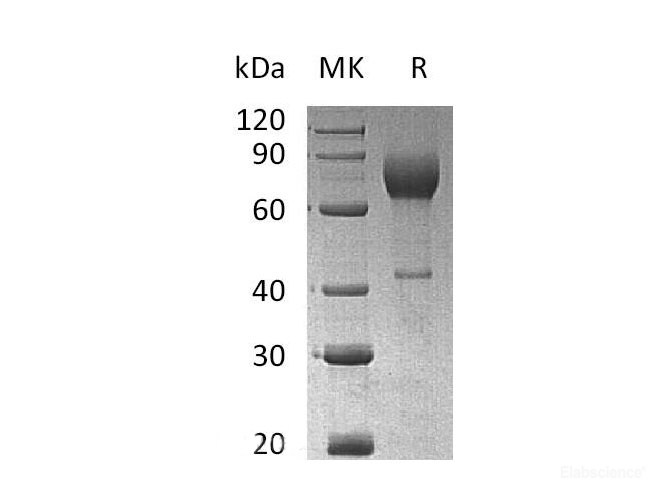 Recombinant Mouse Interleukin-2 receptor subunit alpha Protein-Elabscience