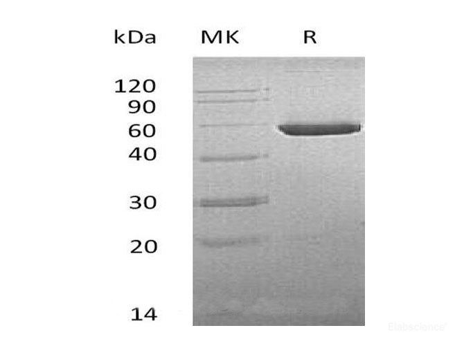 Recombinant Mouse Cytosolic non-specific dipeptidase Protein-Elabscience