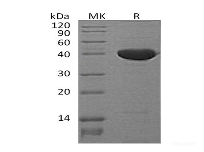 Recombinant Mouse Serine Protease Inhibitor-clade F1 Protein-Elabscience