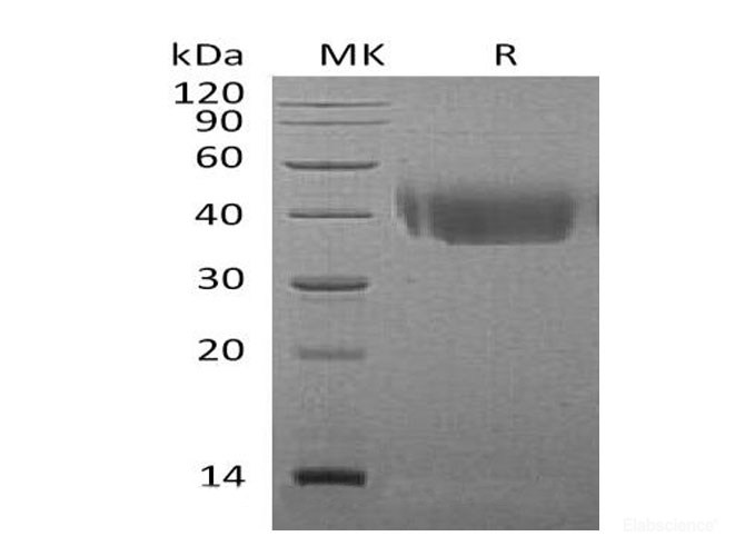 Recombinant Mouse DNAX Accessory Molecule-1 Protein-Elabscience