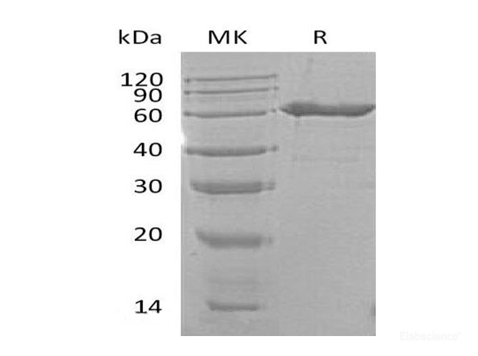 Recombinant Mouse 5'-Nucleotidase Protein-Elabscience