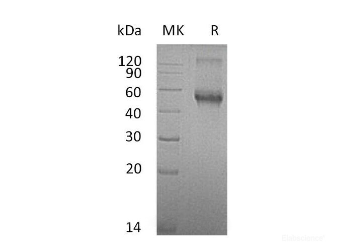 Recombinant Mouse Activin Receptor-like Kinase 1 Protein-Elabscience