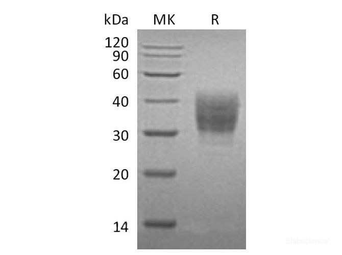 Recombinant Mouse SLAM Family Member 7 Protein-Elabscience