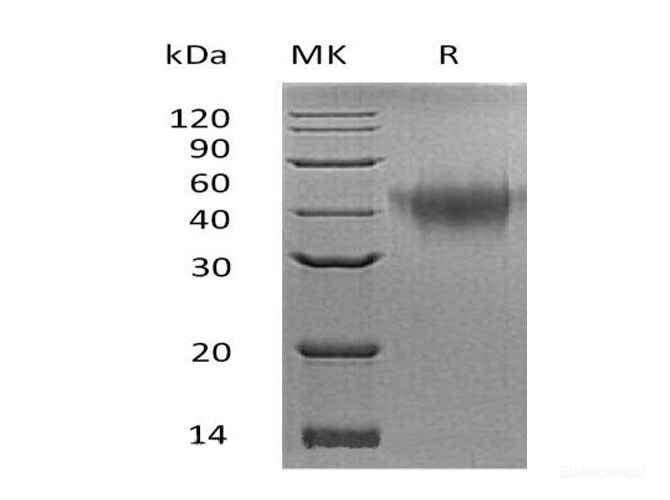 Recombinant Mouse Tumor Necrosis Factor Receptor II Protein-Elabscience
