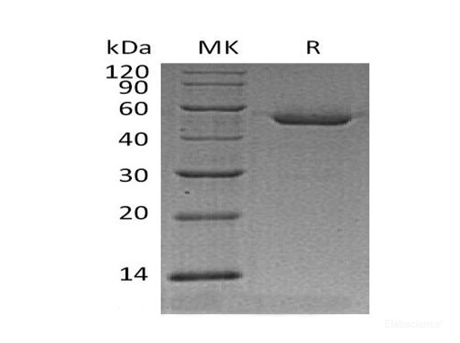 Recombinant Mouse Cathepsin D  Protein-Elabscience