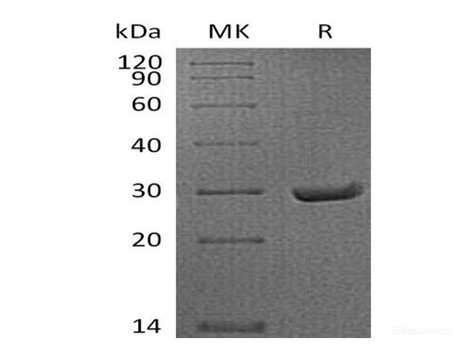Recombinant Mouse Serum Amyloid P Component Protein-Elabscience
