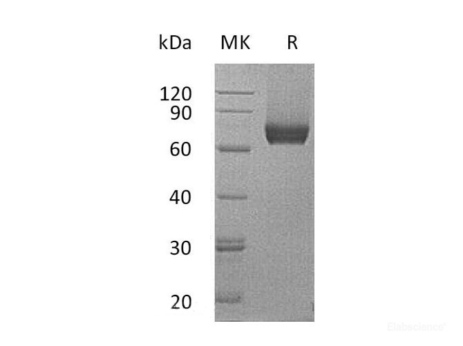 Recombinant Mouse Interleukin-7 receptor subunit alpha Protein-Elabscience