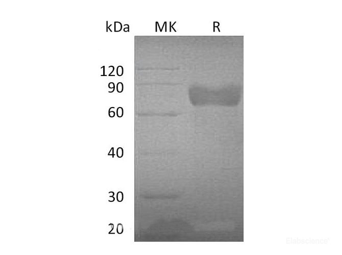 Recombinant Mouse Growth Hormone receptor  Protein-Elabscience