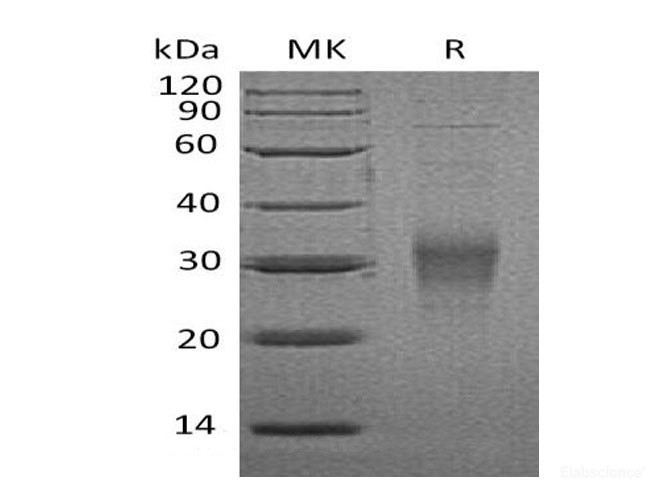 Recombinant Mouse Low Affinity Immunoglobulin Gamma Fc Region Receptor IV Protein-Elabscience