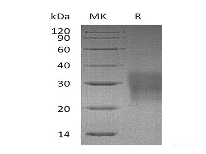 Recombinant Mouse Fas/TNFRSF6/CD95 Protein (His Tag)-Elabscience