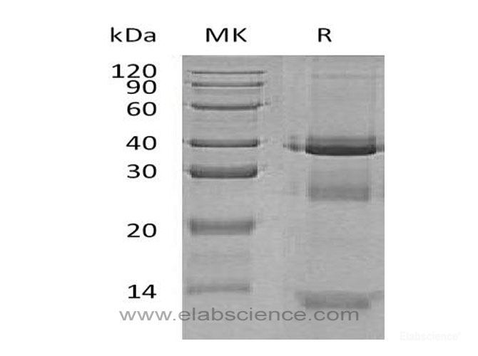Recombinant Mouse Cathepsin L   Protein-Elabscience