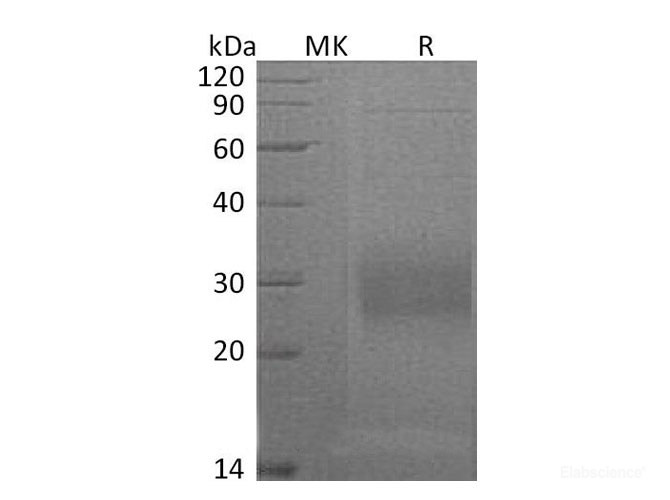 Recombinant Mouse HLA class II histocompatibility antigen gamma chain Protein-Elabscience