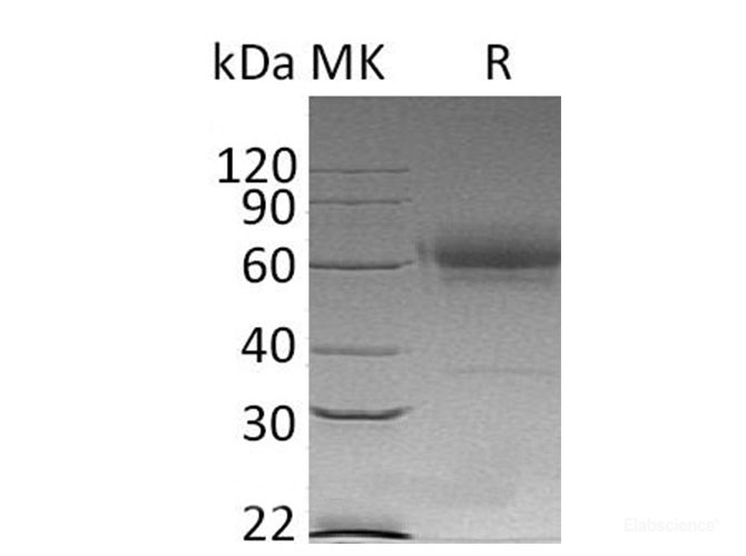 Recombinant Mouse CD27 antigen Protein-Elabscience