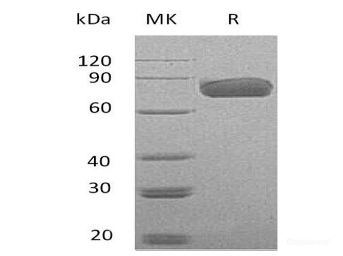 Recombinant Mouse PD-L1 / B7-H1 / CD274 Protein (C-Fc)-Elabscience