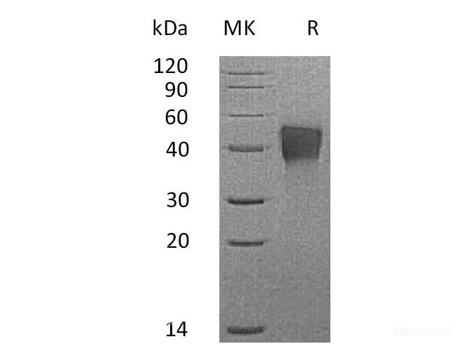 Recombinant Mouse TROP2 / TACSTD2 Protein (C-His)-Elabscience