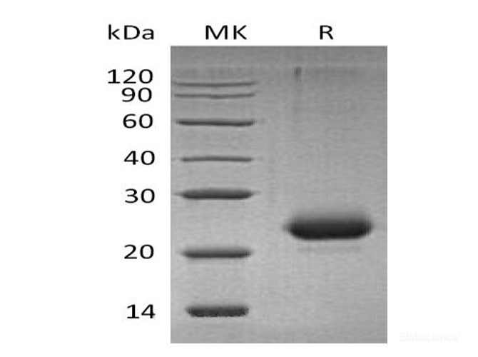 Recombinant Mouse CD40 / TNFRSF5 Protein (C-His)-Elabscience