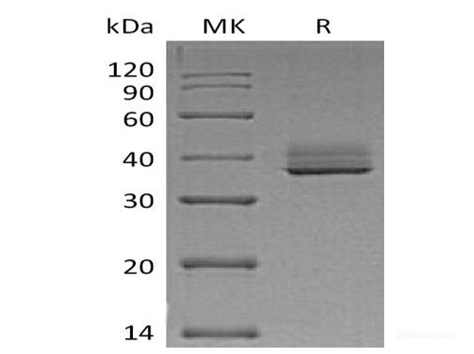 Recombinant Mouse BCMA / TNFRSF17 / CD269 Protein (C-Fc)-Elabscience