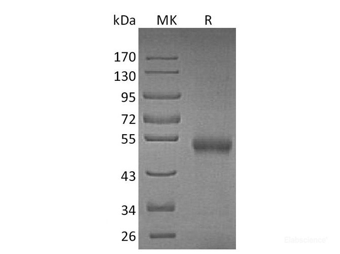 Recombinant Mouse TNFRSF11B / Osteoprotegerin / OPG Protein (C-His)-Elabscience