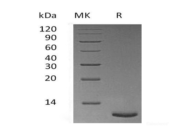 Recombinant Mouse TFF3 / Trefoil Factor 3 Protein (C-His)-Elabscience