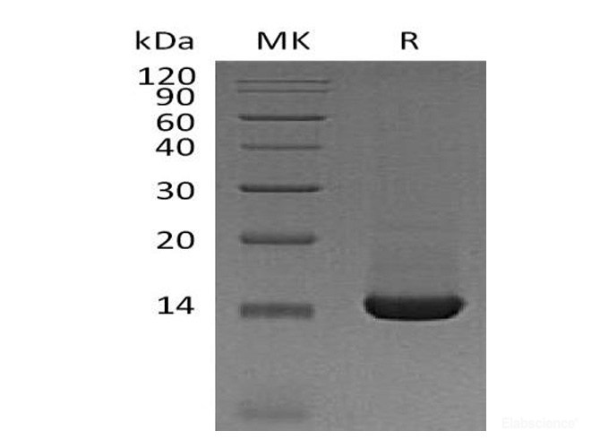 Recombinant Mouse TFF2 / Trefoil factor 2 Protein (C-His)-Elabscience