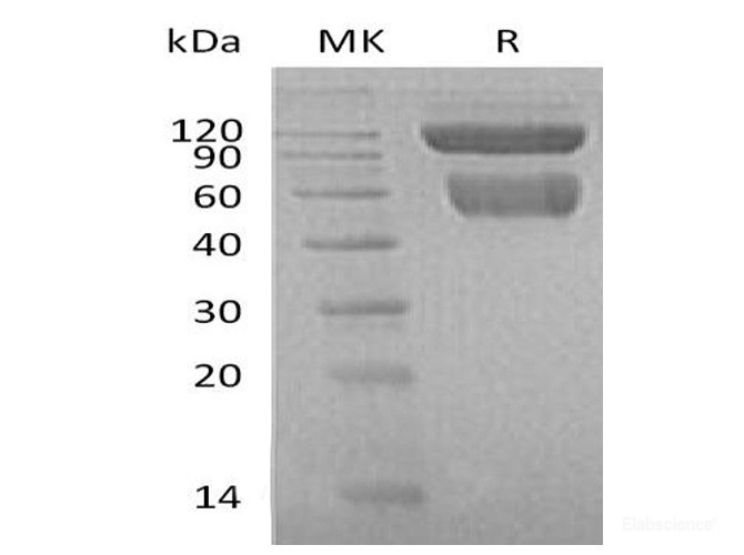 Recombinant Mouse TRAILR2 / TNFRSF10B / CD262 Protein (C-Fc)-Elabscience
